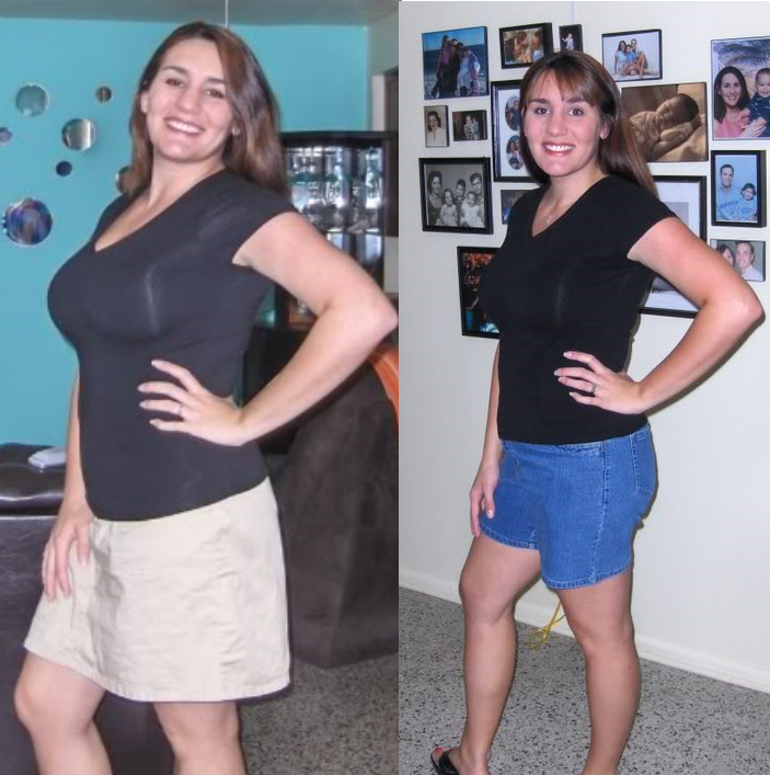 Woman has a weight loss of 25 pounds in two months. Losing weight was easy. 