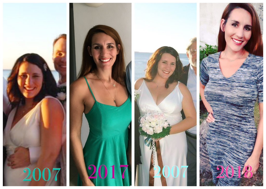95 pound weight loss before and after Before and after weight loss pictures of a woman who lost 95 pounds.